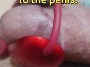 Electric shock to the penis.